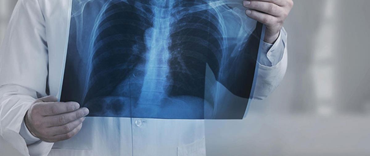 Προληπτικό έλεγχο νεογνών για νωτιαία μυική ατροφία προωθεί το Υπ. Υγείας-«Στόχος η διάγνωση και φαρμακευτική παρέμβαση»