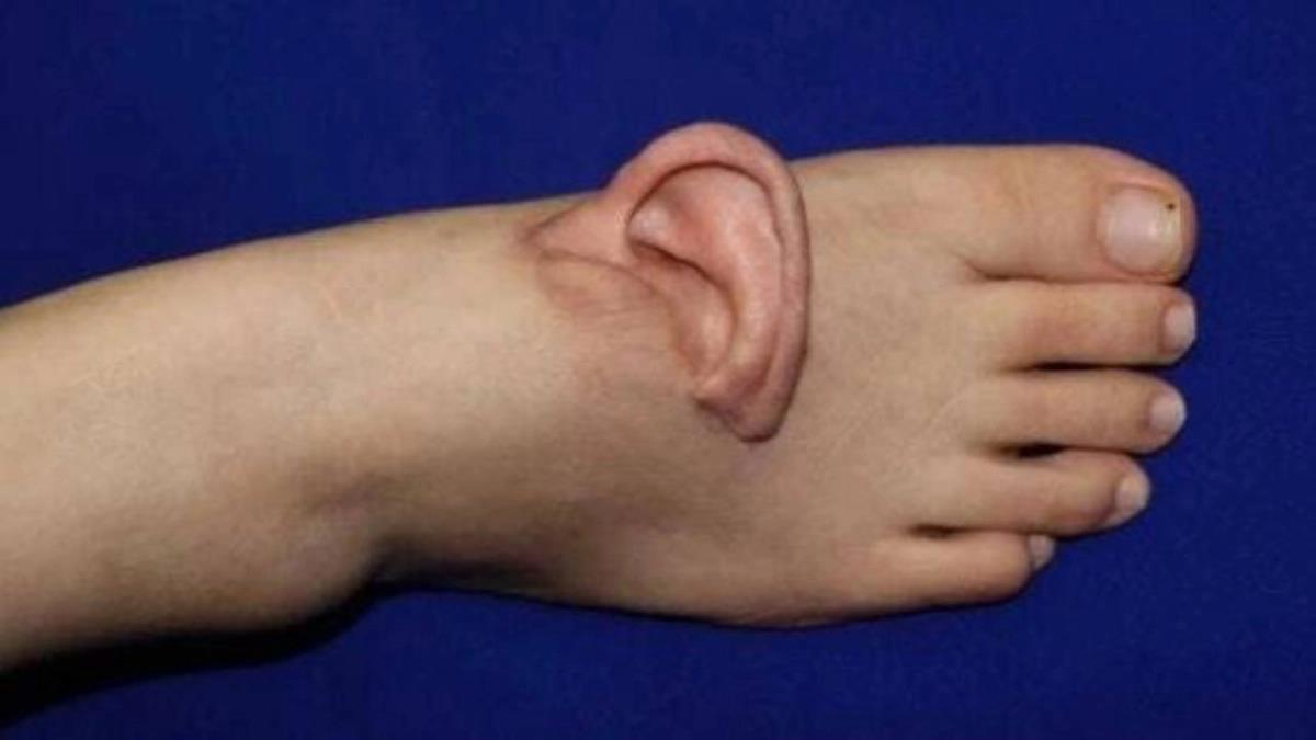 5351533531999988 image