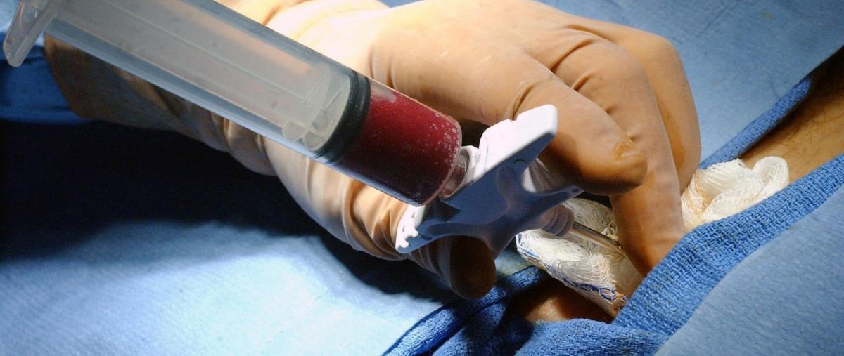 Στην τελική ευθεία οι αλλογενείς μεταμοσχεύσεις-Ανάσα για ασθενείς η έγκριση του νομοσχεδίου