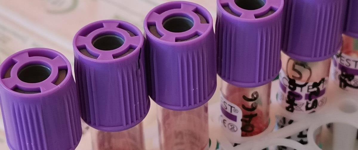 5382445587482126 111666-thalassemia1280