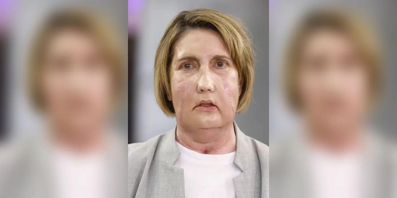 5393004811177187 image