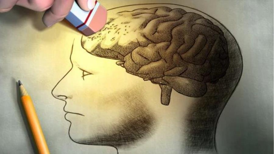 5580263190490266 alzheimer 2