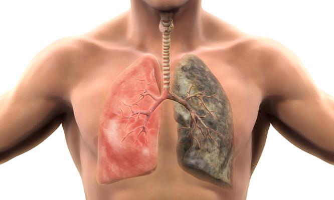 Healthy Lung and Smokers Lung