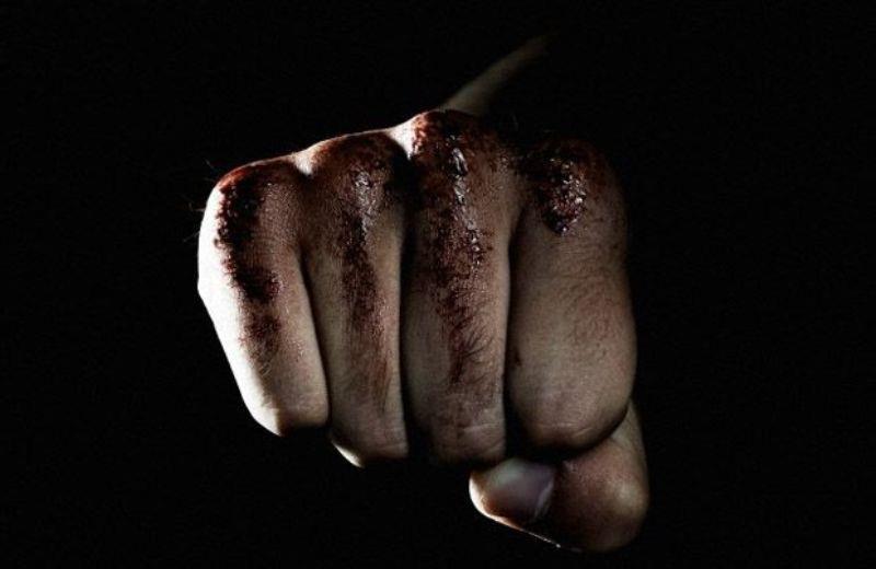 ΕΠΙΘΕΣΗ ΠΑΦΟΣ