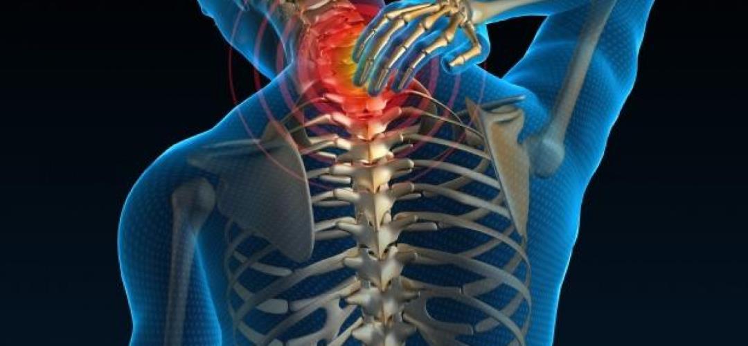 Αυχενικό σύνδρομο