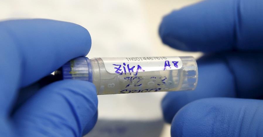 A health technician analyzes a blood sample from a patient bitten by a mosquito at the National Institute of Health in Lima, Peru, February 2, 2016. The laboratory screens blood samples for the Zika virus and other mosquito-borne diseases. REUTERS/Mariana Bazo