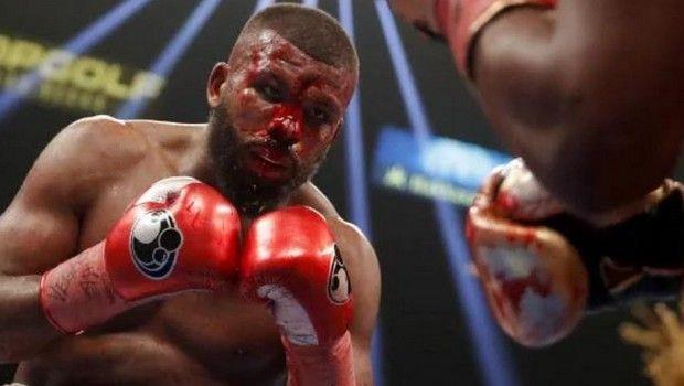 Μία αιματοβαμμένη Κυριακή ήταν για τον Badou Jack η αναμέτρηση με τον Marcus Browne καθώς πέραν την ήττας, προκάλεσε σοκ η εικόνα του Σουηδού μαχητή