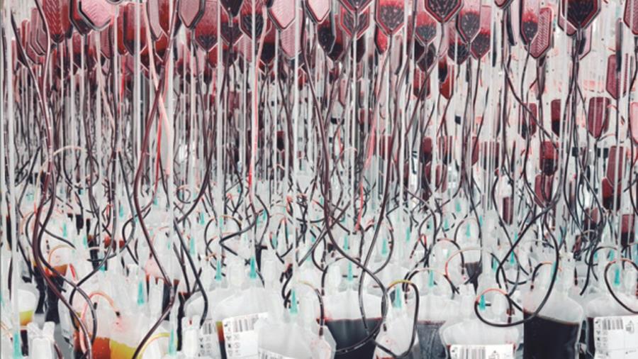 θαλασσαιμία