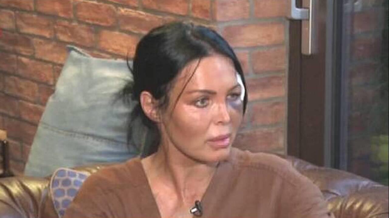 4036129914039803 tzavara