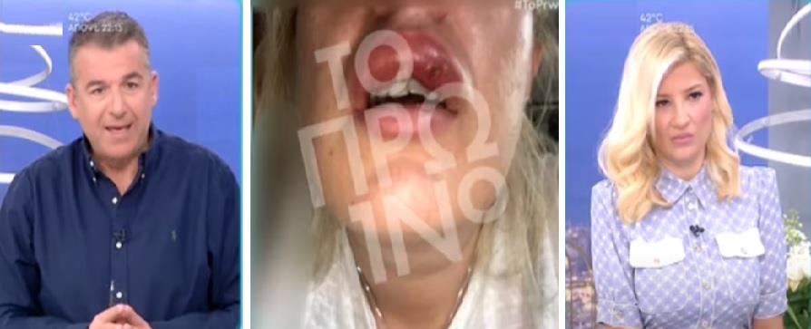 4118245531507551 γγγ