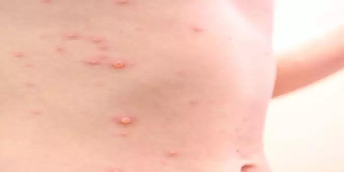 4231596569694521 image