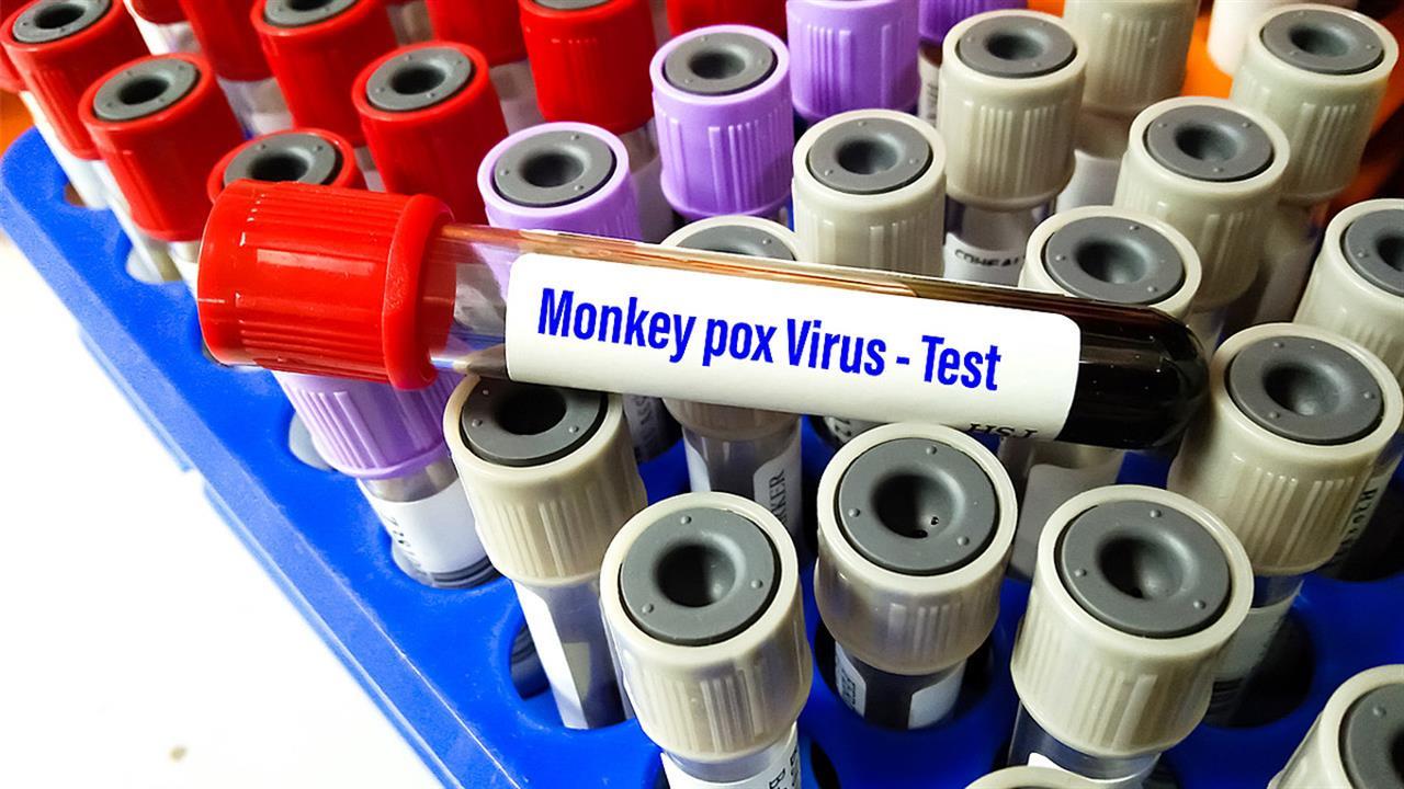 4278159178154141 image