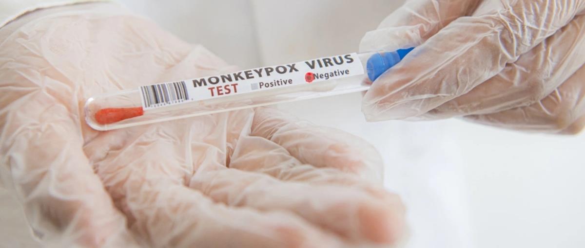 4278294928796937 330