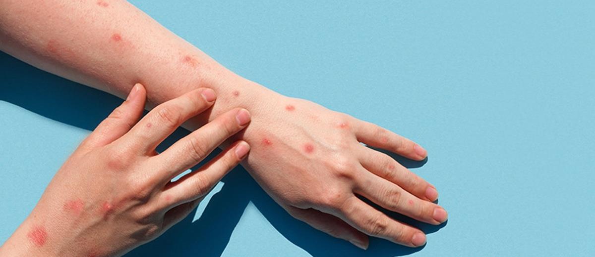 4288583163363252 eulogia