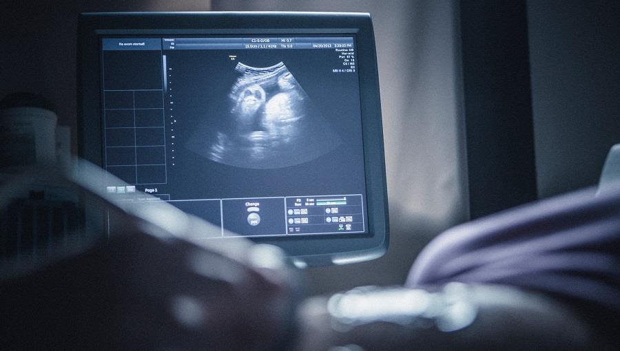 4303453251753464 εμβρυο