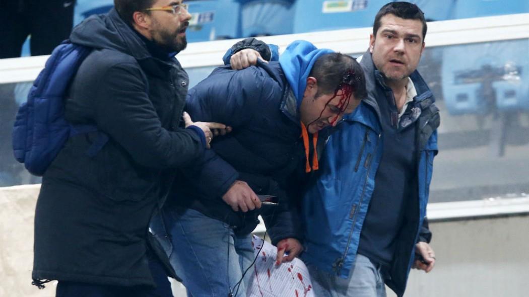 Αγριο ξύλο στο Καυταντζόγλειο μεταξύ οπαδών και ΜΑΤ, με αποτέλεσμα να ανοίξουν κεφάλια και να διακοπεί για λίγο το ματς. Δείτε τις φωτογραφίες και τα βίντεο!