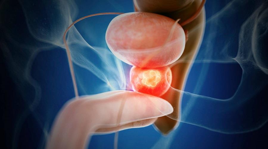 prostate