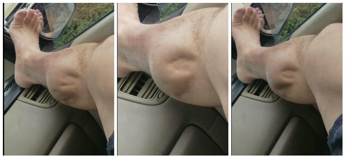 leg